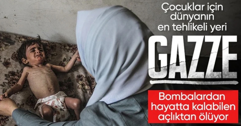 Gazze'de çocuklar yetersiz beslenme nedeniyle ölümle pençeleşiyor